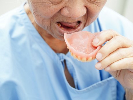 Woman removing her denture after eating a meal