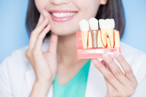 Woman smiling in background while holding a model dental implant in foreground