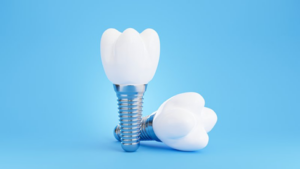 Two dental implants on a blue background